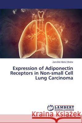 Expression of Adiponectin Receptors in Non-small Cell Lung Carcinoma Abdul Ghafar Jamshid 9783659744471 LAP Lambert Academic Publishing - książka