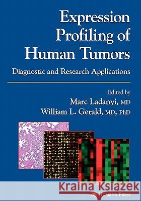 Expression Profiling of Human Tumors: Diagnostic and Research Applications Ladanyi, Marc 9781617373756 Springer - książka