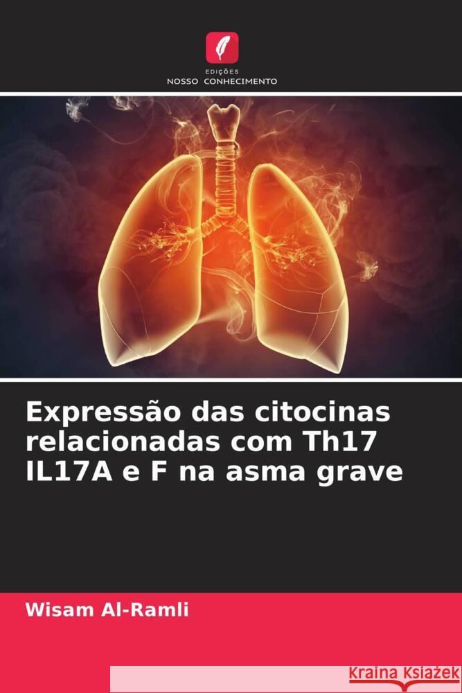 Expressão das citocinas relacionadas com Th17 IL17A e F na asma grave Al-Ramli, Wisam 9786206547952 Edições Nosso Conhecimento - książka