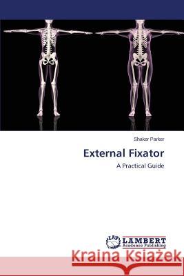 External Fixator Parker Shaker 9783659670039 LAP Lambert Academic Publishing - książka