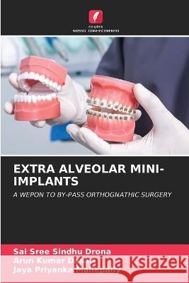 Extra Alveolar Mini-Implants Sai Sree Sindhu Drona Arun Kumar Dasari Jaya Priyanka Mallepally 9786206003403 Edicoes Nosso Conhecimento - książka