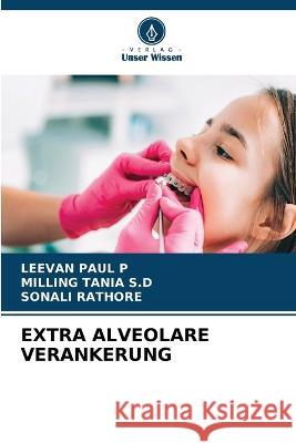 Extra Alveolare Verankerung Leevan Paul P Milling Tania S Sonali Rathore 9786205622780 Verlag Unser Wissen - książka