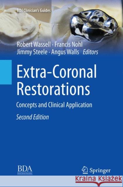 Extra-Coronal Restorations: Concepts and Clinical Application Wassell, Robert 9783030077259 Springer - książka