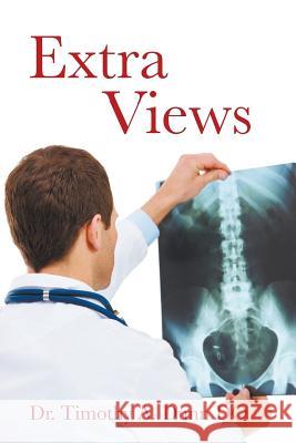 Extra Views: Incidental Findings at a Community Hospital Dr Timothy a. Dun 9781481186759 Createspace - książka