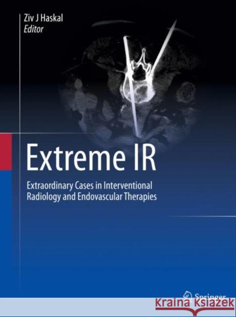 Extreme IR: Extraordinary Cases in Interventional Radiology and Endovascular Therapies Ziv J. Haskal 9783031242502 Springer - książka