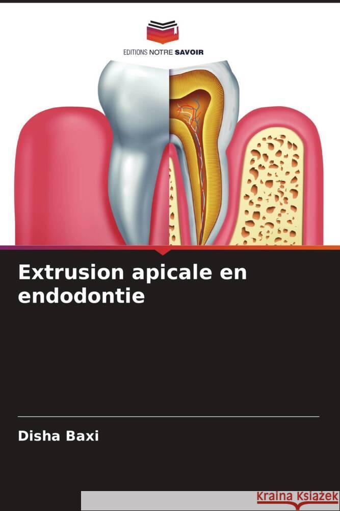 Extrusion apicale en endodontie Baxi, Disha 9786204677798 Editions Notre Savoir - książka