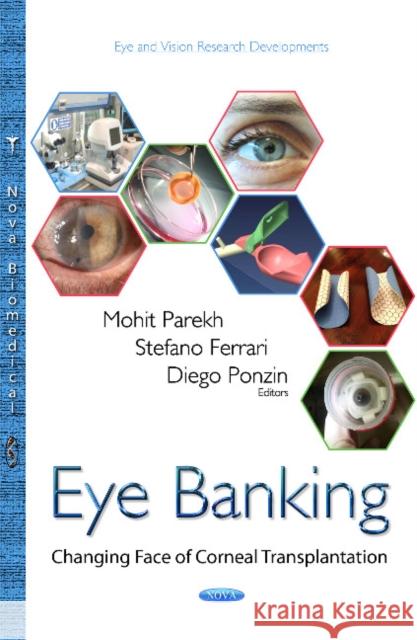 Eye Banking: Changing Face of Corneal Transplantation Mohit Parekh, Diego Ponzin, Stefano Ferrari 9781634826495 Nova Science Publishers Inc - książka