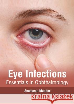 Eye Infections: Essentials in Ophthalmology Anastasia Maddox 9781632417084 Hayle Medical - książka