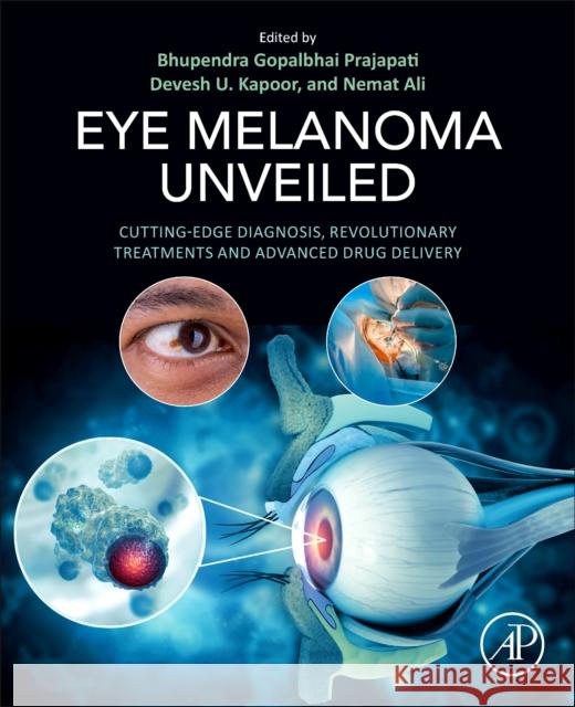 Eye Melanoma Unveiled: Cutting-Edge Diagnosis, Revolutionary Treatments and Advanced Drug Delivery Bhupendra G. Prajapati Devesh U. Kapoor Nemat Ali 9780443275418 Academic Press - książka