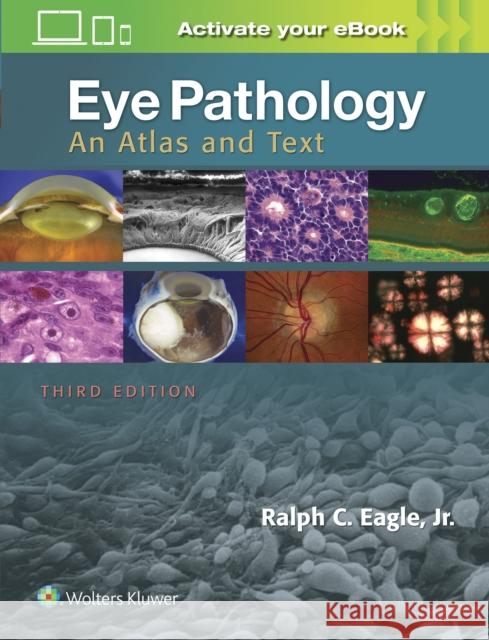 Eye Pathology: An Atlas and Text Ralph C. Eagle 9781496337177 LWW - książka