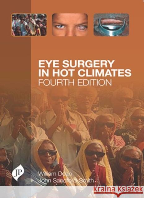 Eye Surgery in Hot Climates William Dean 9781909836235 JP Medical Ltd - książka