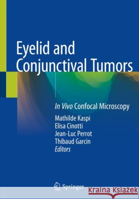 Eyelid and Conjunctival Tumors: In Vivo Confocal Microscopy Kaspi, Mathilde 9783030366087 Springer International Publishing - książka