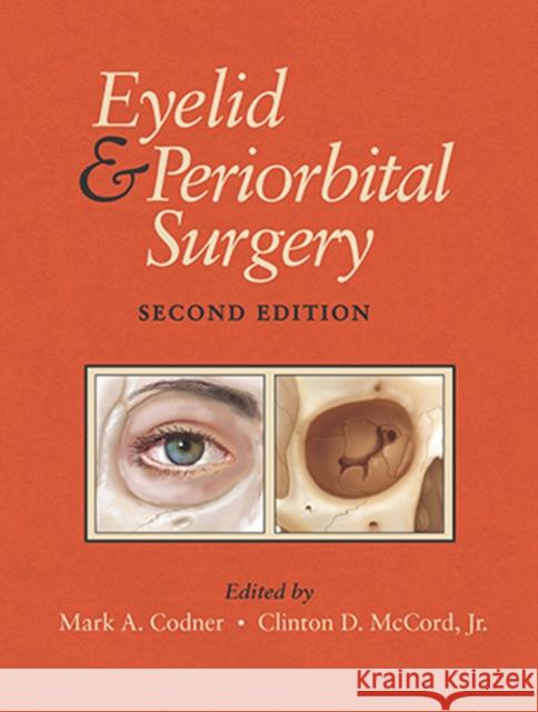 Eyelid and Periorbital Surgery Codner, Mark 9781626237018 Thieme Medical Publishers Inc - książka