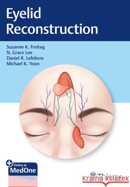 Eyelid Reconstruction Suzanne Freitag Nahyoung Grace Lee Daniel Lefebvre 9781626238237 Thieme Medical Publishers - książka