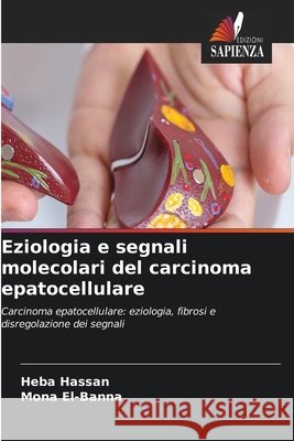 Eziologia e segnali molecolari del carcinoma epatocellulare Hassan, Heba, El-Banna, Mona 9786630264197 Edizioni Sapienza - książka
