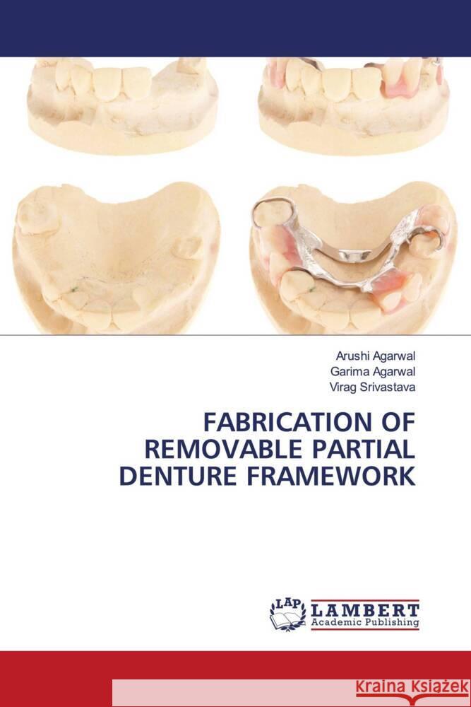 FABRICATION OF REMOVABLE PARTIAL DENTURE FRAMEWORK Agarwal, Arushi, Agarwal, Garima, Srivastava, Virag 9786204199627 LAP Lambert Academic Publishing - książka