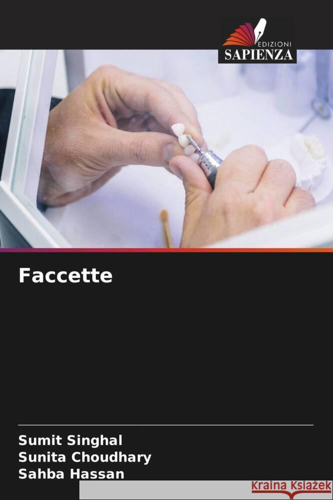 Faccette SINGHAL, SUMIT, Choudhary, Sunita, Hassan, Sahba 9786208317119 Edizioni Sapienza - książka