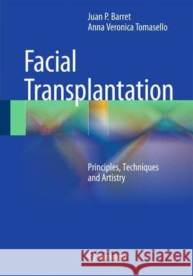 Face Transplantation: Principles, Techniques and Artistry Barret, Juan P. 9783662454435 Springer - książka