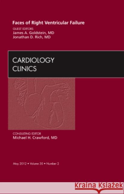 Faces of Right Ventricular Failure, an Issue of Cardiology Clinics: Volume 30-2 Goldstein, James A. 9781455738380 W.B. Saunders Company - książka