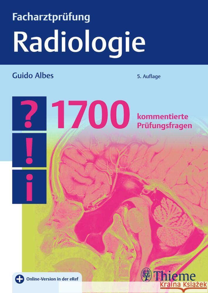 Facharztprüfung Radiologie Albes, Guido 9783132435131 Thieme, Stuttgart - książka