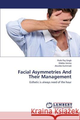 Facial Asymmetries And Their Management Singh Rishi Raj 9783659615122 LAP Lambert Academic Publishing - książka