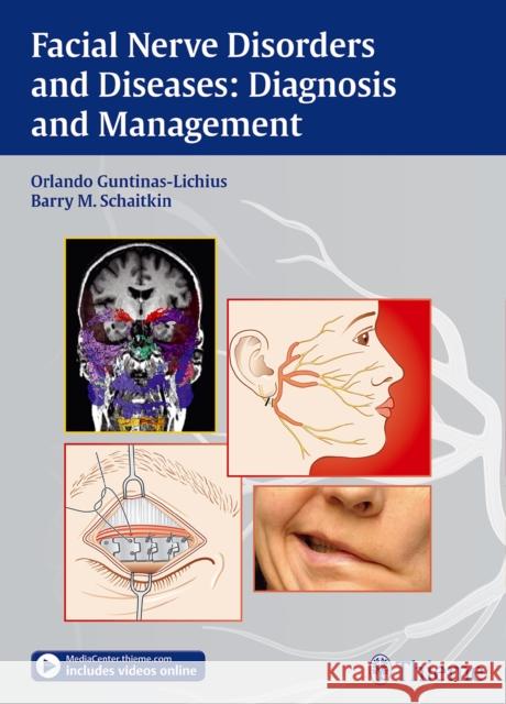 Facial Nerve Disorders and Diseases: Diagnosis and Management Guntinas-Lichius, Orlando 9783131751812 Thieme Medical Publishers - książka