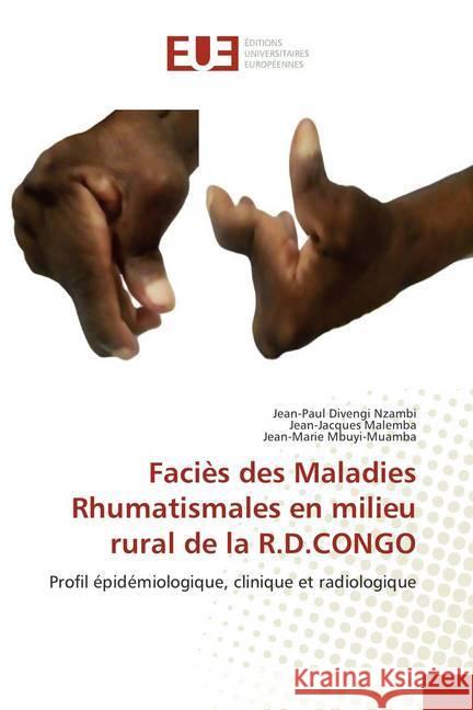 Faciès des Maladies Rhumatismales en milieu rural de la R.D.CONGO : Profil épidémiologique, clinique et radiologique Divengi Nzambi, Jean-Paul; Malemba, Jean-Jacques; Mbuyi-Muamba, Jean-Marie 9786202269995 Éditions universitaires européennes - książka