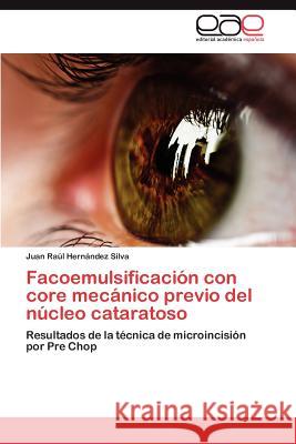 Facoemulsificación con core mecánico previo del núcleo cataratoso Hernández Silva Juan Raúl 9783847353492 Editorial Acad Mica Espa Ola - książka