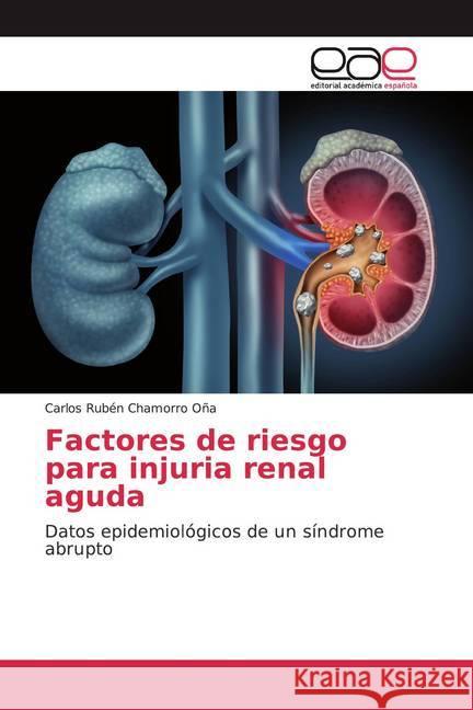 Factores de riesgo para injuria renal aguda : Datos epidemiológicos de un síndrome abrupto Chamorro Oña, Carlos Rubén 9786200377791 Editorial Académica Española - książka