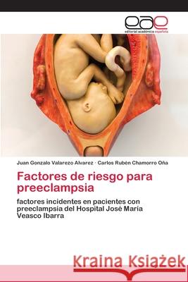 Factores de riesgo para preeclampsia Valarezo Alvarez, Juan Gonzalo 9786200383716 Editorial Académica Española - książka