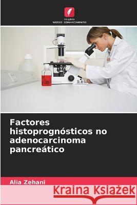 Factores histoprognosticos no adenocarcinoma pancreatico Alia Zehani   9786205921180 Edicoes Nosso Conhecimento - książka