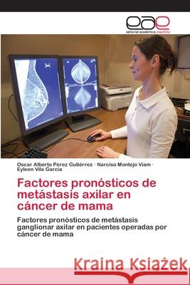 Factores pronósticos de metástasis axilar en cáncer de mama Pérez Gutiérrez, Oscar Alberto 9783659044151 Editorial Acad Mica Espa Ola - książka