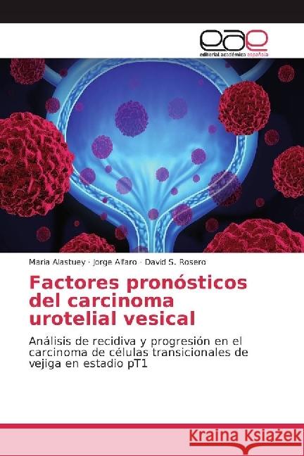 Factores pronósticos del carcinoma urotelial vesical : Análisis de recidiva y progresión en el carcinoma de células transicionales de vejiga en estadio pT1 Alastuey, Maria; Alfaro, Jorge; Rosero, David S. 9783841752284 Editorial Académica Española - książka
