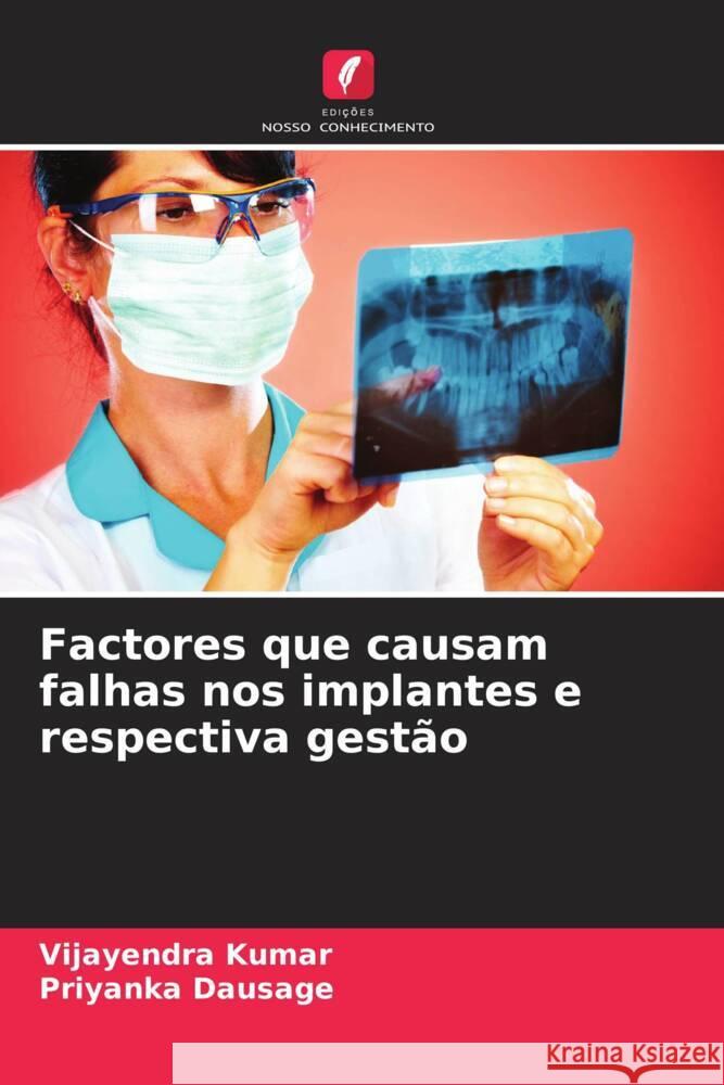 Factores que causam falhas nos implantes e respectiva gestão Kumar, Vijayendra, Dausage, Priyanka 9786208228231 Edições Nosso Conhecimento - książka