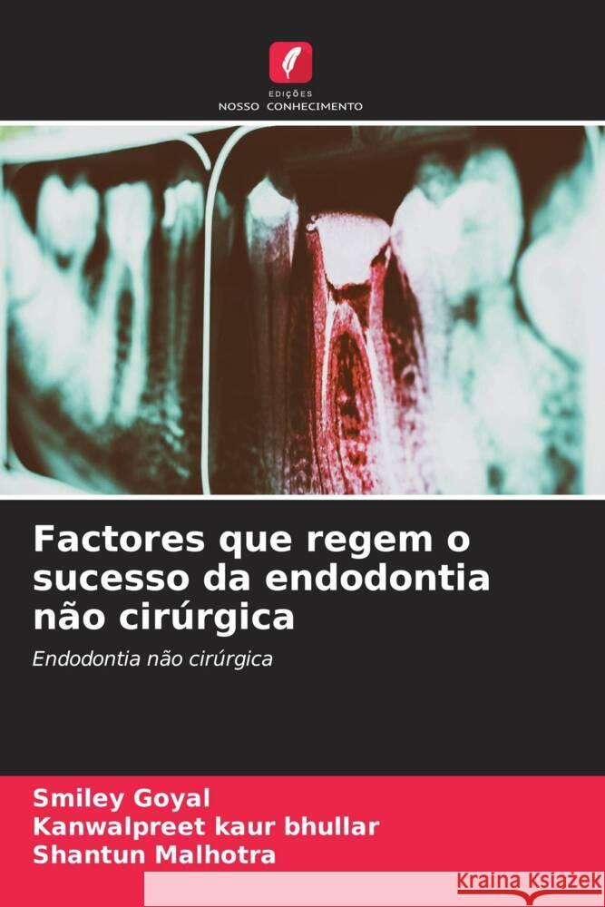 Factores que regem o sucesso da endodontia não cirúrgica Goyal, Smiley, Kaur Bhullar, Kanwalpreet, Malhotra, Shantun 9786204996899 Edições Nosso Conhecimento - książka