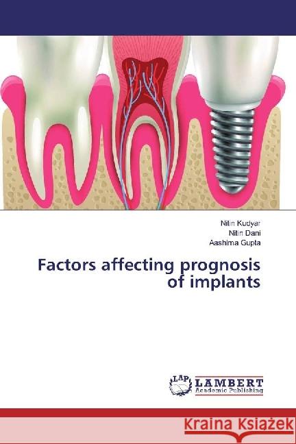 Factors affecting prognosis of implants Kudyar, Nitin; Dani, Nitin; Gupta, Aashima 9786202015806 LAP Lambert Academic Publishing - książka