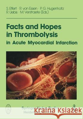 Facts and Hopes in Thrombolysis in Acute Myocardial Infarction S. Effert 9783662071762 Steinkopff-Verlag Darmstadt - książka