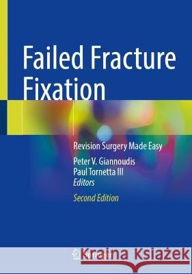 Failed Fracture Fixation: Revision Surgery Made Easy Peter V. Giannoudis Paul Tornett 9783031396915 Springer - książka