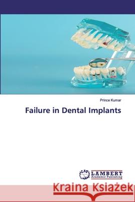 Failure in Dental Implants Kumar, Prince 9786202526593 LAP Lambert Academic Publishing - książka