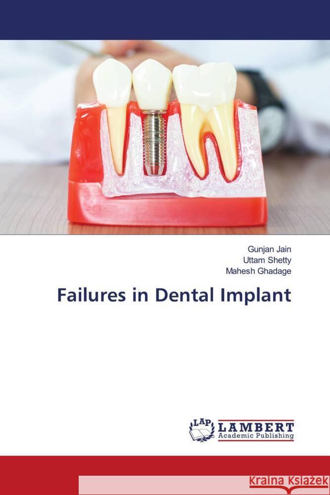 Failures in Dental Implant Jain, Gunjan, Shetty, Uttam, Ghadage, Mahesh 9786204986364 LAP Lambert Academic Publishing - książka