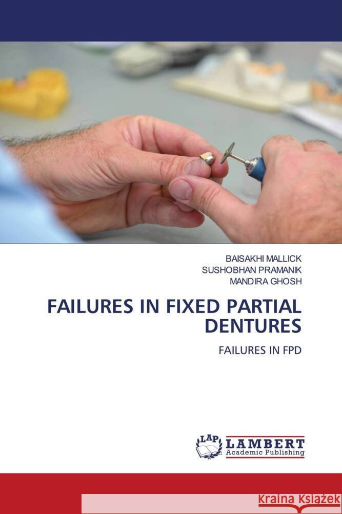 FAILURES IN FIXED PARTIAL DENTURES MALLICK, BAISAKHI, PRAMANIK, SUSHOBHAN, GHOSH, MANDIRA 9786206790914 LAP Lambert Academic Publishing - książka