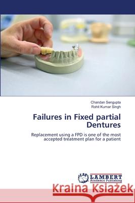 Failures in Fixed partial Dentures Chandan SenGupta Rohit Kumar Singh 9786207477500 LAP Lambert Academic Publishing - książka