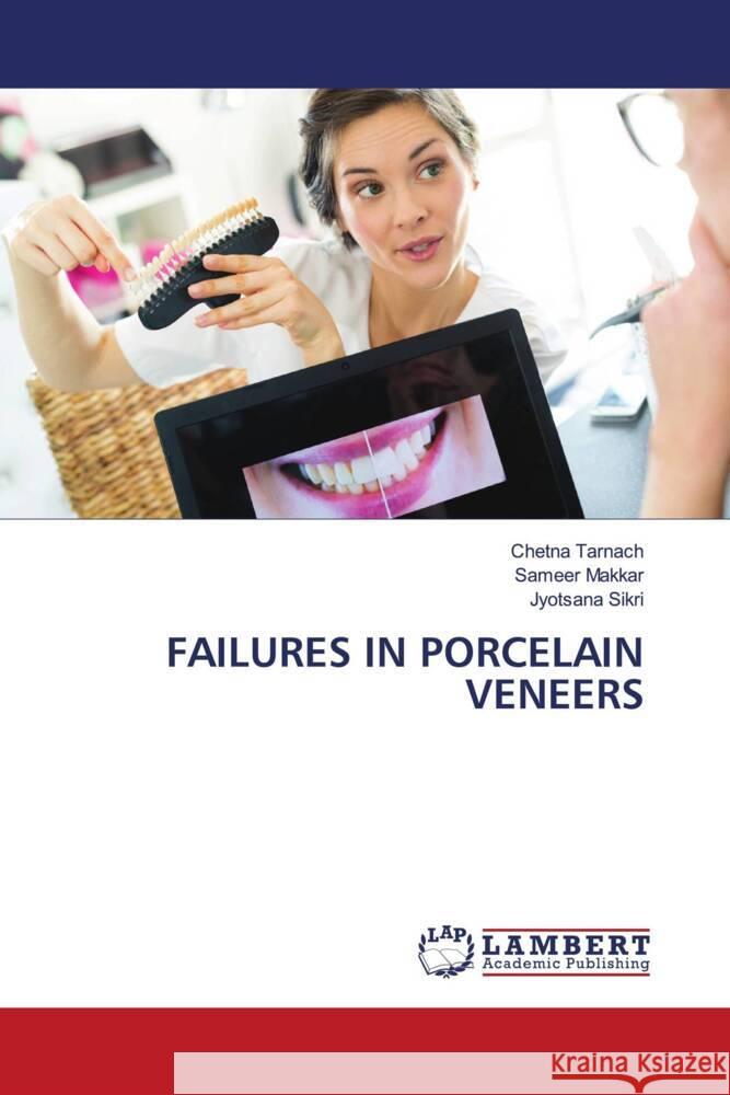 Failures in Porcelain Veneers Chetna Tarnach Sameer Makkar Jyotsana Sikri 9786207470358 LAP Lambert Academic Publishing - książka