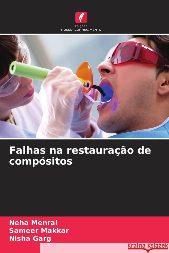 Falhas na restauração de compósitos Menrai, Neha, Makkar, Sameer, Garg, Nisha 9786205443026 Edições Nosso Conhecimento - książka