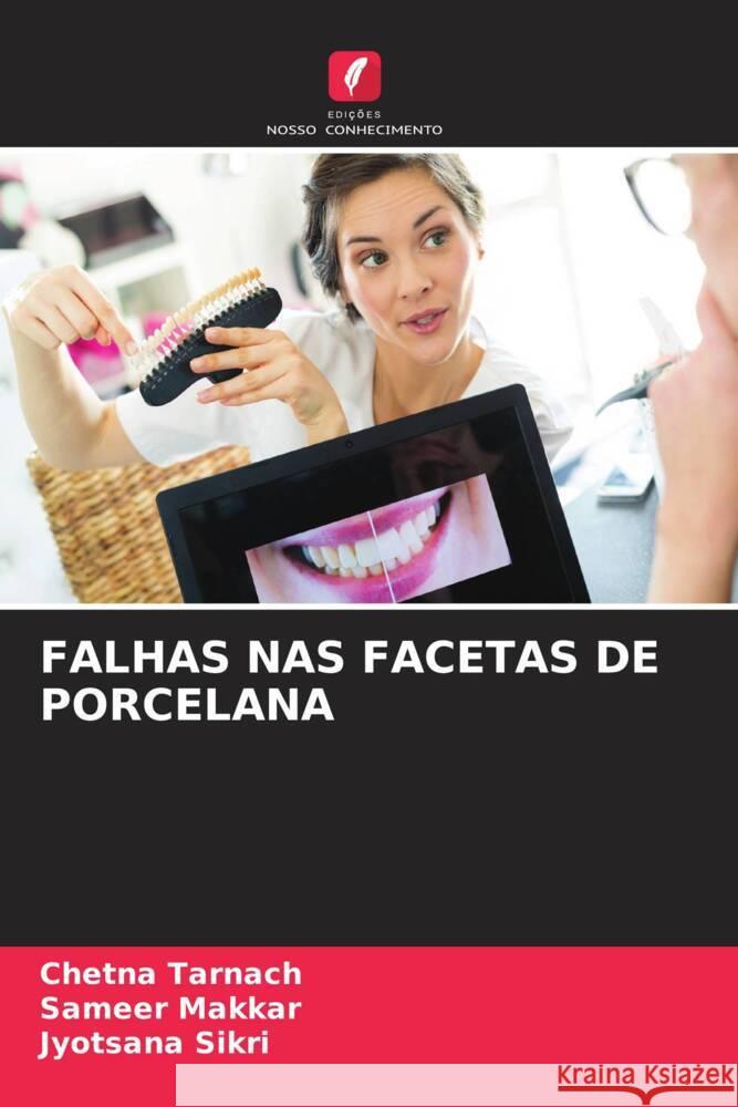 Falhas NAS Facetas de Porcelana Chetna Tarnach Sameer Makkar Jyotsana Sikri 9786207339778 Edicoes Nosso Conhecimento - książka