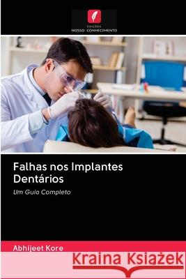 Falhas nos Implantes Dent Abhijeet Kore 9786202861960 Edicoes Nosso Conhecimento - książka