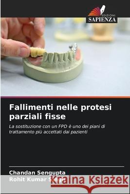 Fallimenti nelle protesi parziali fisse Chandan SenGupta Rohit Kumar Singh 9786207552061 Edizioni Sapienza - książka