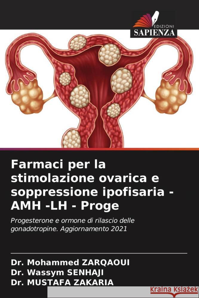 Farmaci per la stimolazione ovarica e soppressione ipofisaria -AMH -LH - Proge Zarqaoui, Dr. Mohammed, SENHAJI, Dr. Wassym, Zakaria, Dr. Mustafa 9786204525877 Edizioni Sapienza - książka