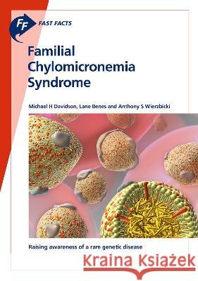 Fast Facts: Familial Chylomicronemia Syndrome Davidson, Michael H., Benes, Lane, Wierzbicki, Anthony S. 9783318069846 S. Karger - książka