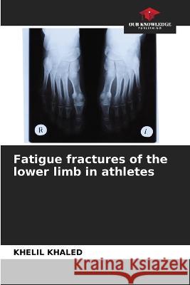 Fatigue fractures of the lower limb in athletes Khelil Khaled 9786205619759 Our Knowledge Publishing - książka